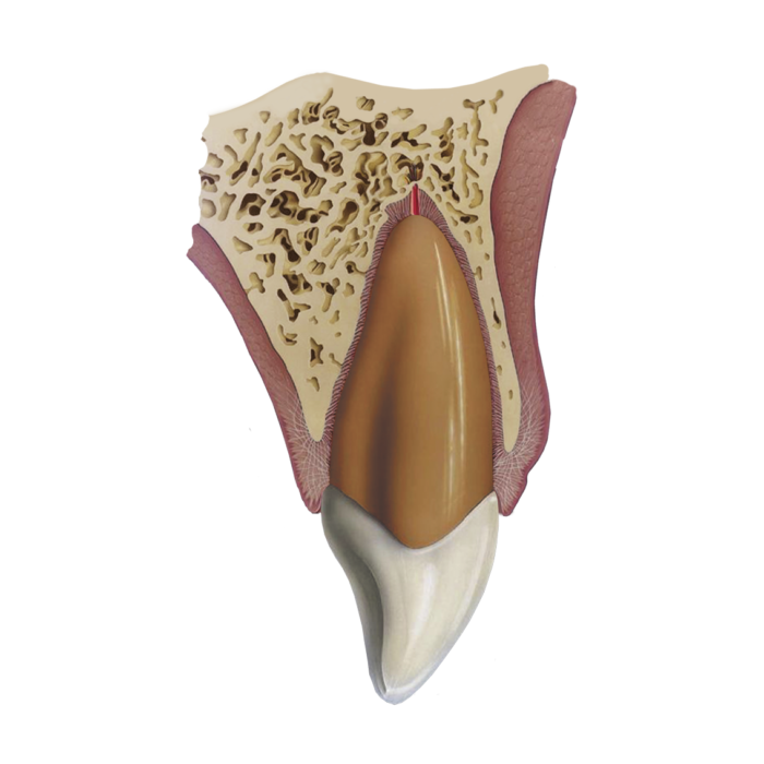 Dental Traume Guide